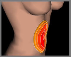 Intuitive interface for high definition liposuction