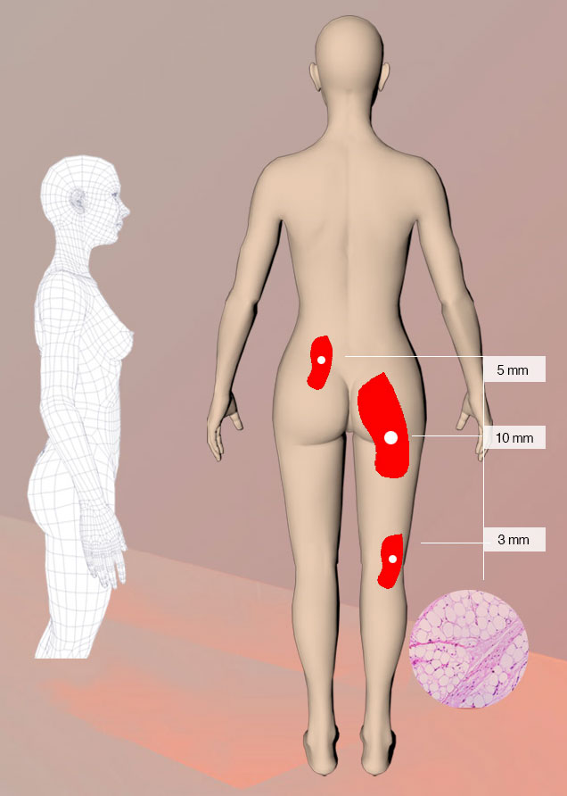 3l 3d-hd scan of body fat