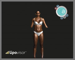 example screenshot software for high definition liposuction
